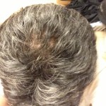 僕が白髪な理由はなぜでしょう？？