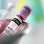 血液中の栄養素を分析してみたら・・・